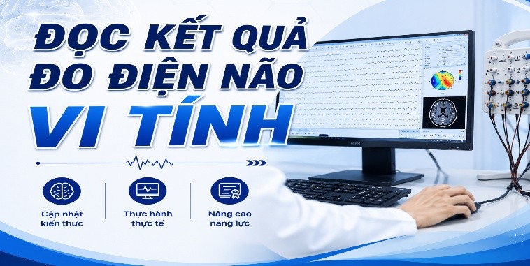 Đọc kết quả đo điện não vi tính